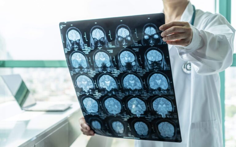 Beyin Cerrahisi ve Sinir Hastalıkları