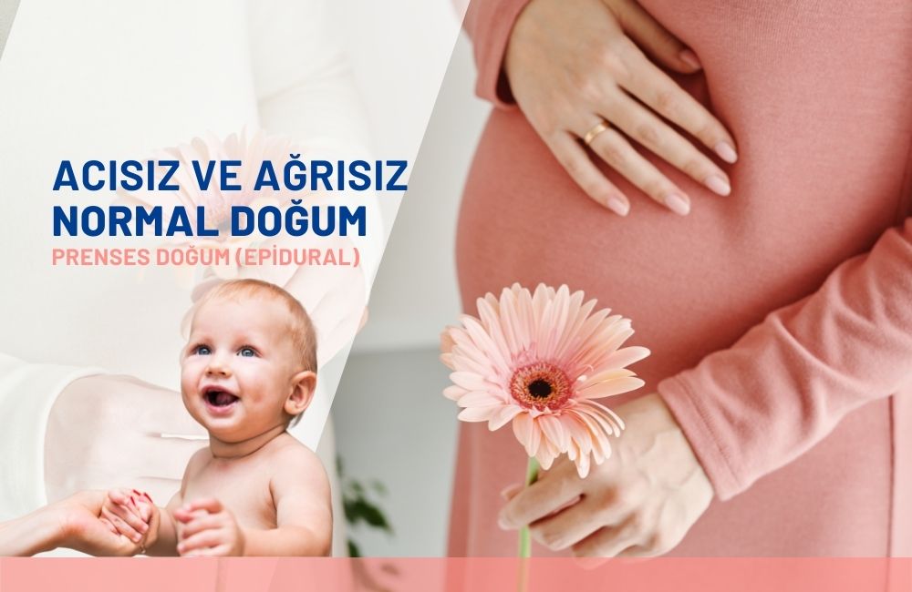 Epidural Doğum